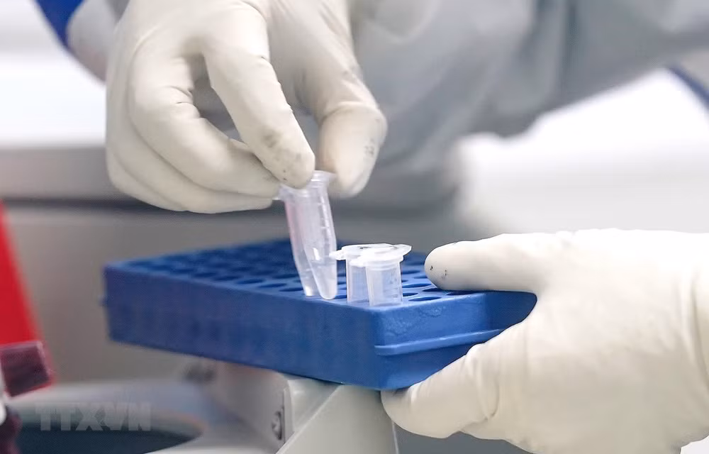 Le Japon aide l'Institut Pasteur de Ho Chi Minh-Ville à répondre à COVID-19 ảnh 1