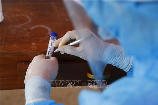 COVID-19 : plus de 303.400 patients déclarés guéris ce mardi ảnh 1