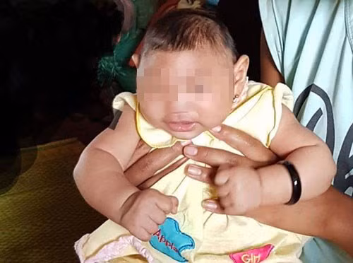 Le Vietnam annonce un premier cas d’enfant atteint d’une microcéphalie ảnh 1 Le Vietnam annonce un premier cas d’enfant atteint d’une microcéphalie ảnh 1