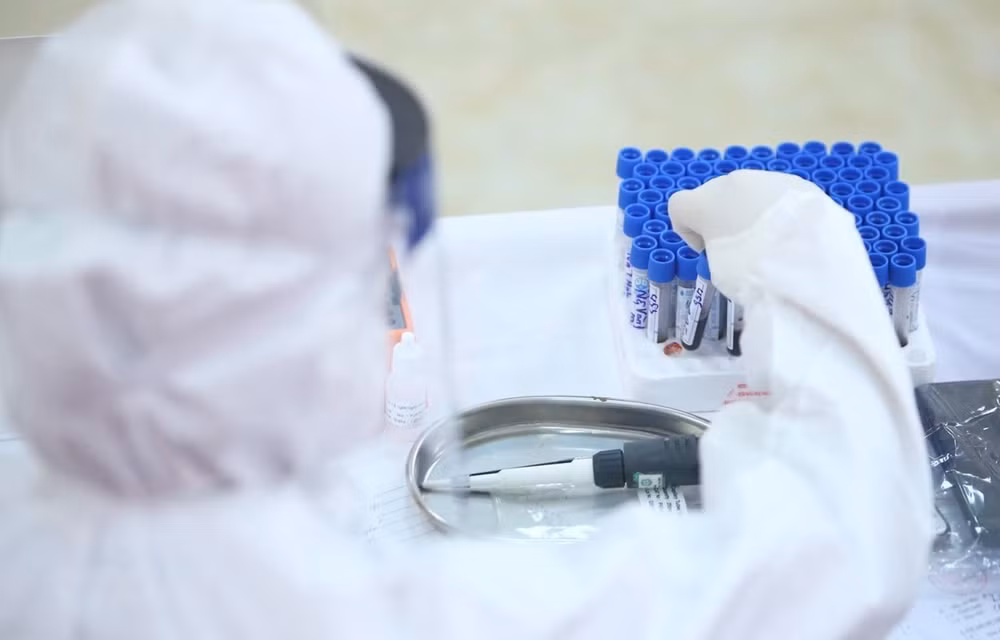 COVID-19 : le Vietnam recense quatre nouveaux cas ce mardi ảnh 1
