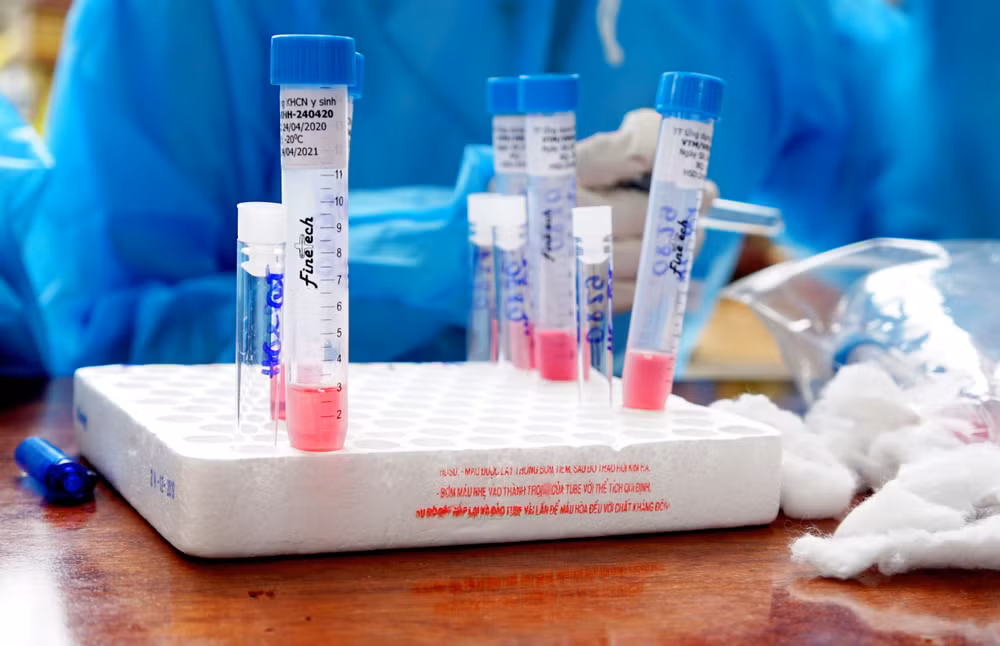 COVID-19: Onze nouveaux cas enregistrés portent le nombre total d'infections du Vietnam à 2.472 ảnh 1