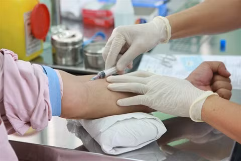 La prise en charge du VIH/SIDA par l’assurance-santé en question ảnh 3