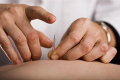 L’acupuncture au service de l’autisme infantile