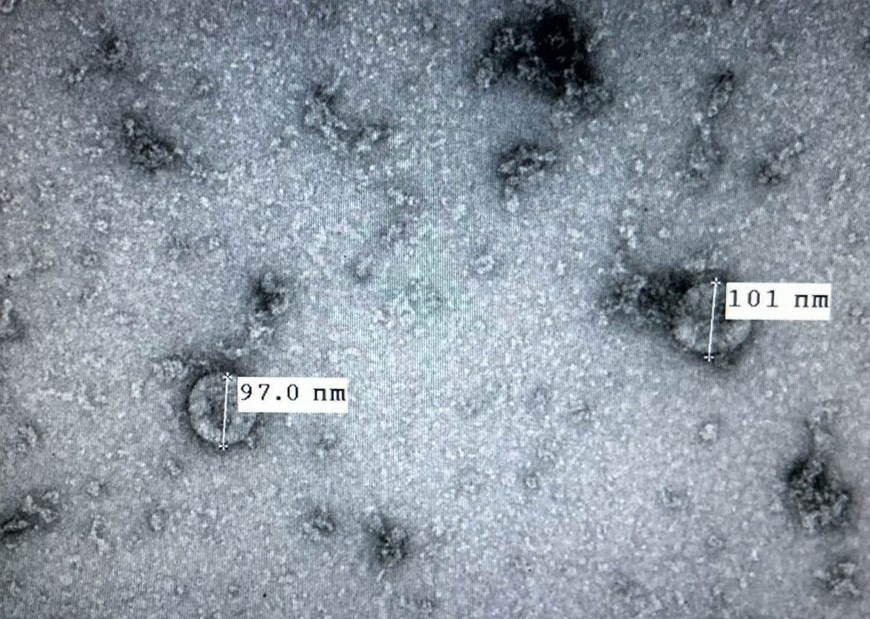 Le 7 février 2020, l'Institut national d'hygièe et d'épidémiologie annonce le succès de la culture et de l'isolement du nouveau coronavirus provoquant le COVID-19, facilitant les tests de dépistage. C'est le prémisse pour la recherche et le développement de vaccins contre ce virus. 