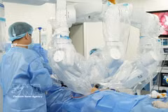 Chirurgie robotique à distance. Photo: VNA