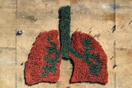 Les Philippines établissent un record mondial pour la plus grande image de poumon humain