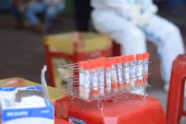 COVID-19: 77 nouveaux cas de transmission locale confirmés dimanche après-midi