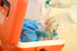 COVID-19: le Vietnam confirme le 11e décès