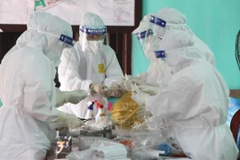 COVID-19: 88 nouveaux cas confirmés dans le bilan actualisé à midi ​
