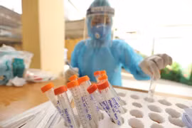 COVID-19 : 4.564 nouveaux cas confirmés samedi soir