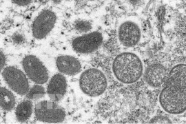 Le Vietnam n’a enregistré aucun cas de variole du singe 