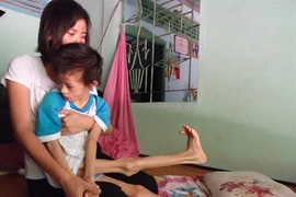 Vinmec : les cellules souches au secours de la paralysie cérébrale