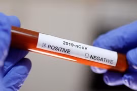 COVID-19 : le Vietnam signale un nouveau cas de contamination 