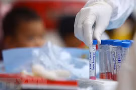 Coronavirus : le Vietnam n’enregistre aucun nouveau cas en 37 jours