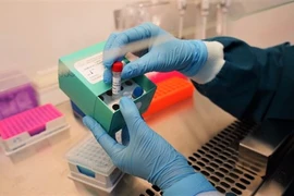 Vinmec a développé avec succès deux kits de dépistage du SARS-CoV-2