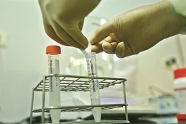 De la polio au Covid-19 : les progrès des vaccins "made in Vietnam"
