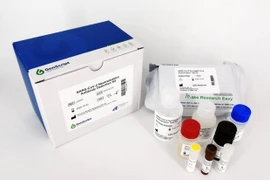 Singapour développe un kit de test rapide du coronavirus 