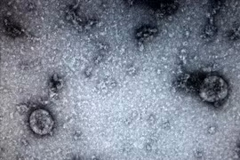 Le Vietnam a réussi à cultiver et à isoler les souches du nCoV