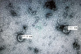 Mise en culture du coronavirus : une avancée majeure pour le Vietnam