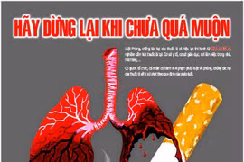 Le Vietnam, lauréat un Prix Bloomberg Philanthropies pour la réduction du tabagisme