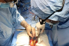 6.000 enfants vietnamiens souffrant des maladies cardiaques opérés gratuitement