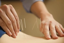 Le Vietnam et le Japon renforcent leur coopération dans la médecine traditionnelle