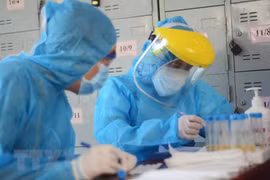 COVID-19 : 102 nouveaux cas et deux décès supplémentaires confirmés dans le bilan actualisé à midi