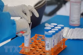 COVID-19 : 353 nouveaux cas détectés samedi après-midi