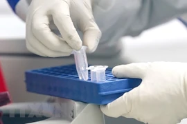 COVID-19 : Hanoï recherche et teste de toute urgence les cas contacts du Japonais décédé