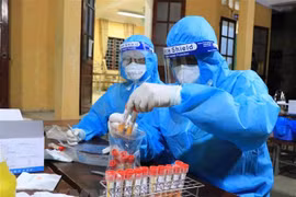 COVID-19 : 94 cas supplémentaires détectés samedi