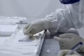 COVID-19 : 159 nouveaux cas confirmés mercredi matin au Vietnam