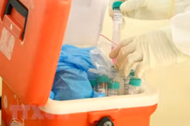 COVID-19 : un nouveau décès confirmé