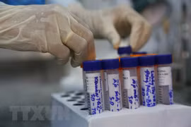 COVID-19 : 62 nouveaux cas confirmés vendredi soir