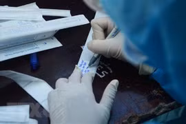 COVID-19 : 48 nouveaux cas signalés mardi soir