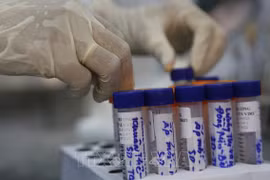 COVID-19 : le total s’établit à 12.231 cas confirmés 