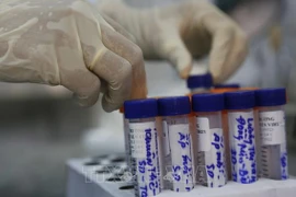 COVID-19 : le total s’établit à 12.231 cas confirmés 