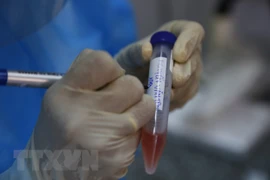 COVID-19 : le Vietnam confirme deux décès supplémentaires