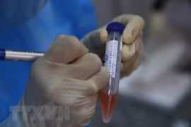 COVID-19 : le Vietnam confirme deux décès supplémentaires