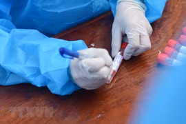 COVID-19: 28 nouveaux cas détectés au Vietnam