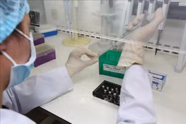 10 000 kits de tests de dépistage du coronavirus offerts au ministère de la Santé 