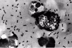 La bactérie Yersinia pestis, responsable de la peste, dont la forme la plus courante est la peste bubonique, se transmet généralement par la piqûre de puces infectées. Photo : Centres pour le contrôle et la prévention des maladies (CDC) des États-Unis.
