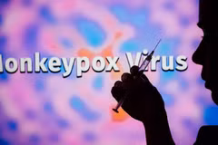 Le Vietnam n'enregistre pas de cas de Monkeypox (variole du singe)