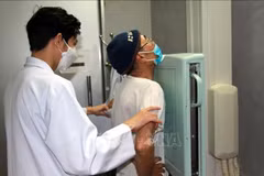 Plus de 103.000 cas de tuberculose détectés au Vietnam en 2022